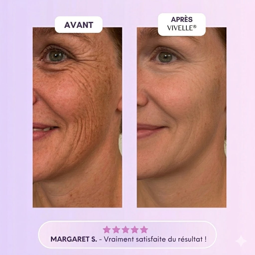 Vivelle™ Bandes de Collagènes pour Cicatrices & Rides