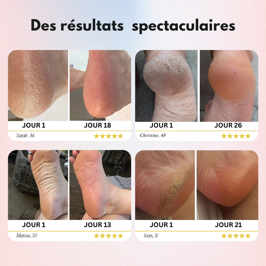 InnoPieds™ - Outil de Soin Podologique