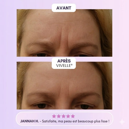 Vivelle™ Bandes de Collagènes pour Cicatrices & Rides
