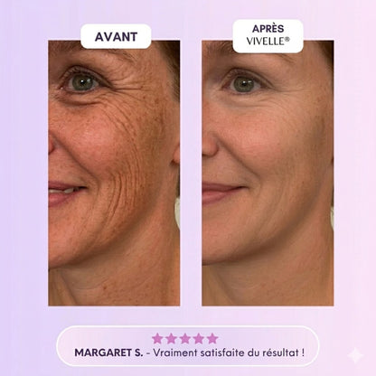 Vivelle™ Bandes de Collagènes pour Cicatrices & Rides
