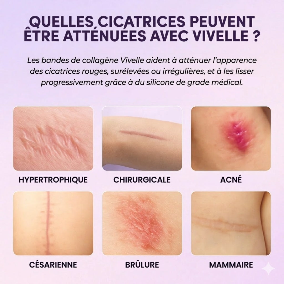Vivelle™ Bandes de Collagènes pour Cicatrices & Rides