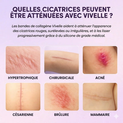 Vivelle™ Bandes de Collagènes pour Cicatrices & Rides